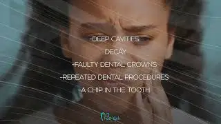Why Root Canal?