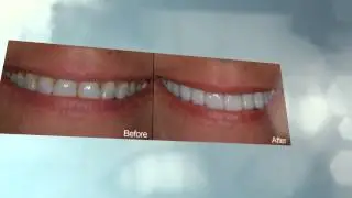 Palm Beach Gardens Dentists