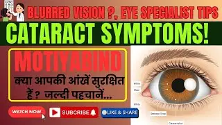 Cataract Symptoms, Treatment | Motiyabind का पूरा सच | Causes, & Surgery | Dr. Aseem Agarwal
