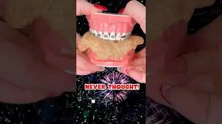 HOW CLOSE to 1 MILLION?! 🤯 #braces #1million #crunchy