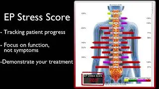 MyoVision Minute: EP Stress Score