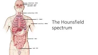 CT101: Hounsfield Units