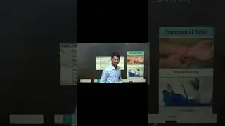 rabies treatment plan | rabies | dog bite par Kya kare | कुत्ते के काटने पर क्या करना चाहिए 