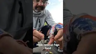 Hook removal from hand #fishing #largemouthbassin #hook