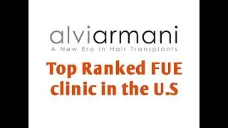 Dr Baubac Los Angeles Hair Transplant Results