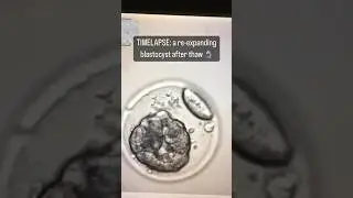BLASTOCYST RE-EXPANSION #fertility #infertility #IVF #ICSI #IUI #FET #blastocyst #embryologist