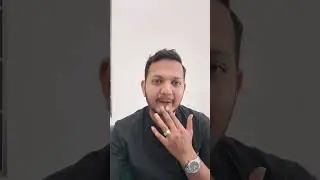 ❌ Getters Are NOT Cached in TypeScript 😱 | Angular Devs Must Know