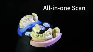 3D Dental Scanner for Laboratory with Blokbuster Speed and Accuracy