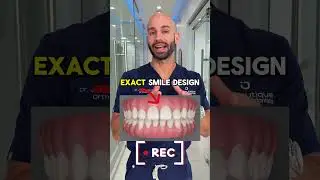 How We Plan an Adult Invisalign Smile Transformation