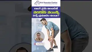 Is Standing the Real Cause of Varicose Veins? Doctor Explains | Dr Rajah V Koppala | Avis Hospital