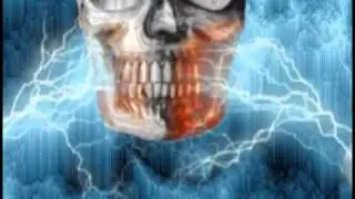 Skullcracker HD Trailer