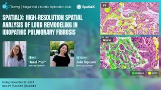 EP17: SpatialX: High-Resolution Spatial Analysis of Lung Remodeling in Idiopathic Pulmonary Fibrosis