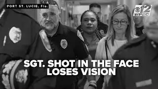 Sergeant shot in the face twice has minimal vision but 'able to walk,' police chief says