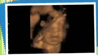 Baby Girl | 28 Weeks Pregnant | 2D/3D/4D Ultrasound