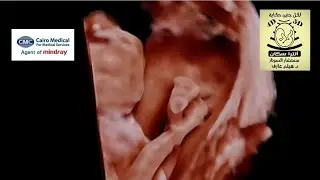 Wt u think 🤔? Follow the hashtag #ultrascan_fetal_ultrasound_school 