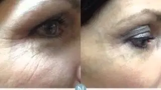 Nerium AD Age Defying Night and Day Cream Complete Kit