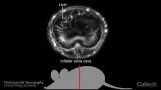 Photoacoustic Tomography - Lihong Wang Lab