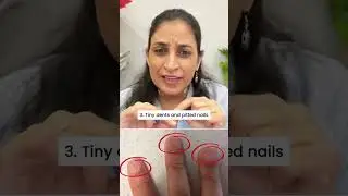 Your Child&rsquo;s Nails Can Reveal Hidden Health Problems! 👀 | Pediatrician Explains