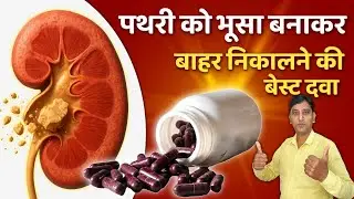 This medicine will convert the stone into husk and take it out || Best Kidney Stone Cracker Medic...