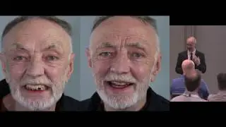 Finlay Sutton: Improving Denture Aesthetics and Function Part A