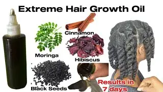 Grow Your Edges Back FAST! DIY Hair Growth Oil for Bald Spots & Thin Hairline