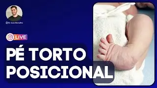 Pé torto posicional - exclusivo para fisioterapeutas