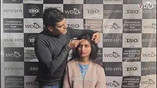 Best Human Hair Toppers for Thinning Hair  Natural Look, Real Volume & Confidence Boost