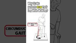 Why Stroke Patients Drag their Leg while walking?