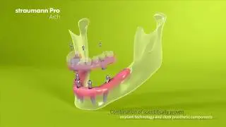All on four