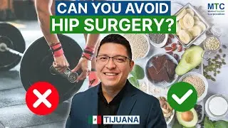 Affordable Hip Replacement in Tijuana, Mexico: Procedure, Recovery, & Prevention Tips!