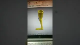 prosthetic leg Design 