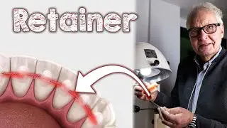 Retainer - Scheinbar harmlos - Tatsächlich aber mit negativen gesundheitlichen Folgen