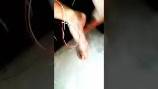Self Needling for Lower Back Strain