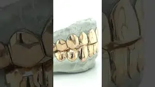 18k gold perm cut grillz by Seattle Gold Grills