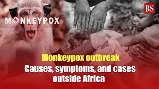 Monkeypox outbreak: Causes, symptoms, and cases outside Africa