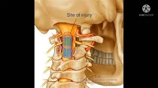 First time visit Cured  Many Years Neck Problem !!