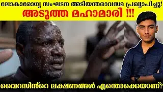 Next Pandemic? Emergency! | Mpox virus Malayalam | Monkey pox virus | Malayalam