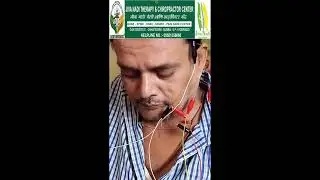 Bell's palsy acupuncture treatment by Mumbai best Chiropractor Dr saurabh at Jiva Nadi - Mulund 