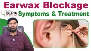 Ear Wax Problems: Symptoms, Causes, Treatment || Dr Harika ENT Care Hospital