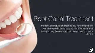 Seapoint Clinic - Root Canal Treatment