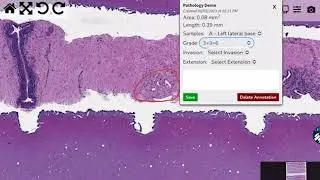 ZayaAI 2025 Digital Pathology LIMS