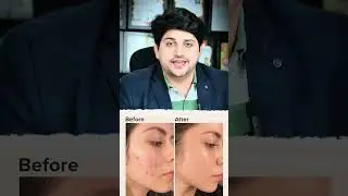 Psoriasis & Eczema Problems |✅ Natural Skin Care & Relief at SMT Clinic #healthyindia#naturalhealing