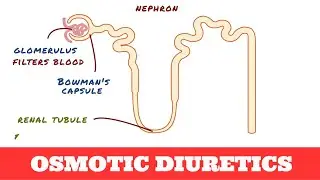 Osmotic Diuretics - Mannitol