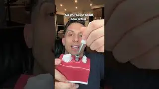 Lost a Tooth? These Are Your Best Options!