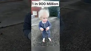 Rarest Human Genetics 🧬 #viral #trending #shorts