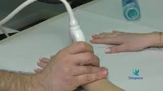 Artrite reumatoide
