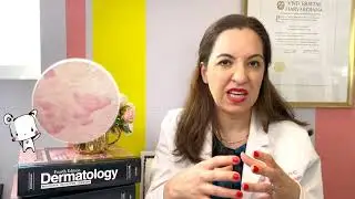 Do Food Allergies Cause Eczema? A Dermatologist Explains - Dr. Heidi Goodarzi