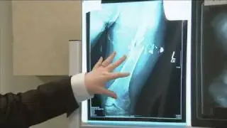 Radiologic Technology Program at Harper College