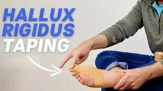 Hallux Rigidus Taping | Big Toe Arthritis Taping