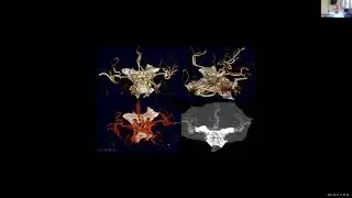 Introduction to Neuroimaging w/Dr. Pramanik 7/7